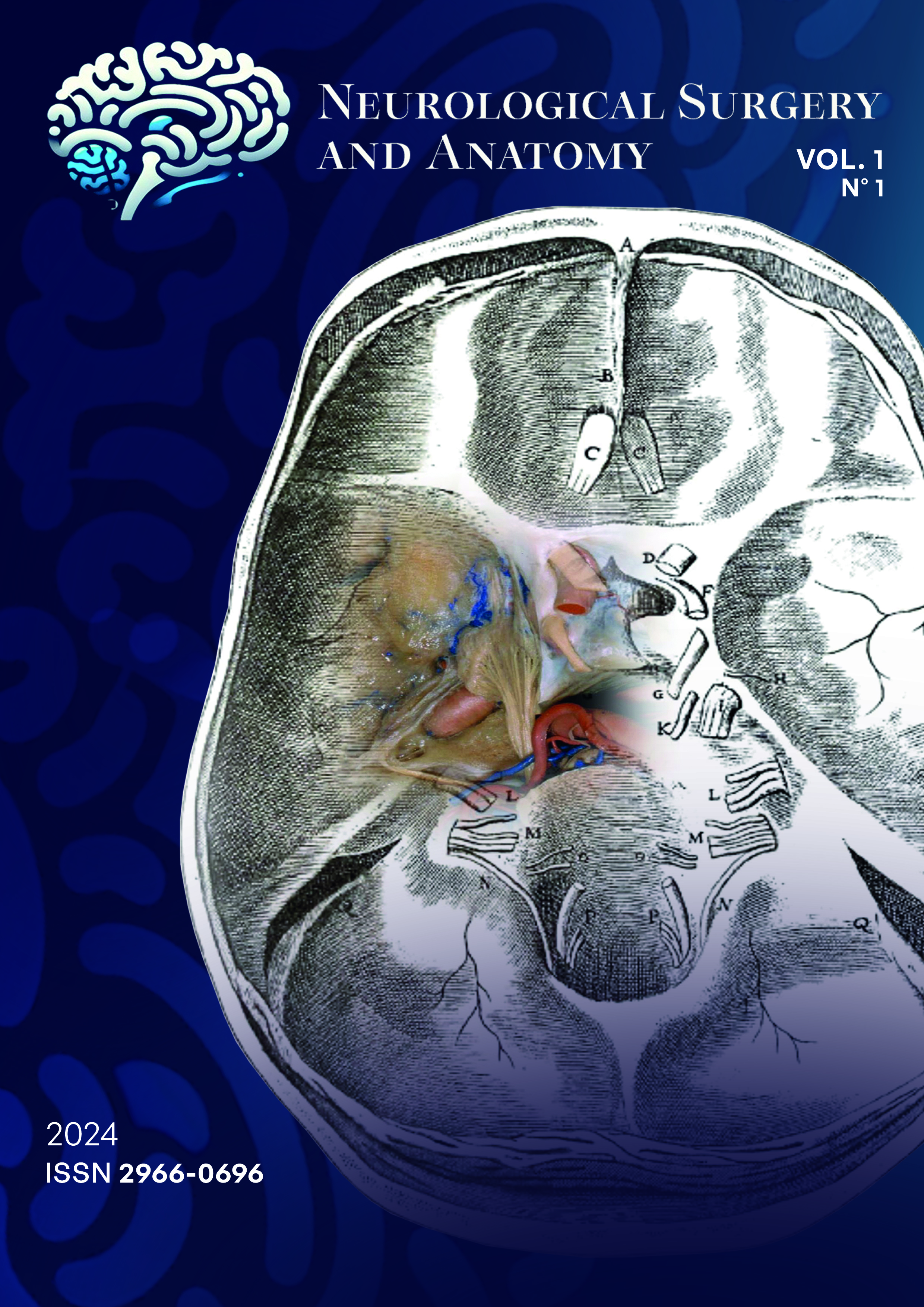 A composite including the fifth figure of Willis´ Cerebri Anatome embedded with a modern image of an injected cadaveric head, dissected under the magnification of the surgical microscope at Rhoton´s Lab – US is presented. Martins, A. C. de A., Martins, C., & Valenca, M. M. (2024). 360 years of Cerebri Anatome. Neurological Surgery and Anatomy, 1(1).